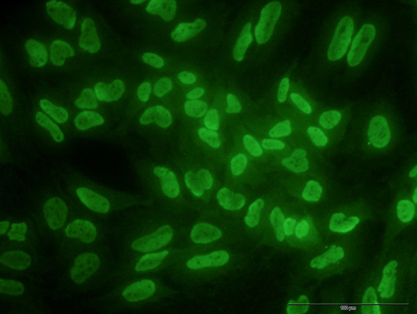 ARID1B Antibody in Immunocytochemistry (ICC/IF)