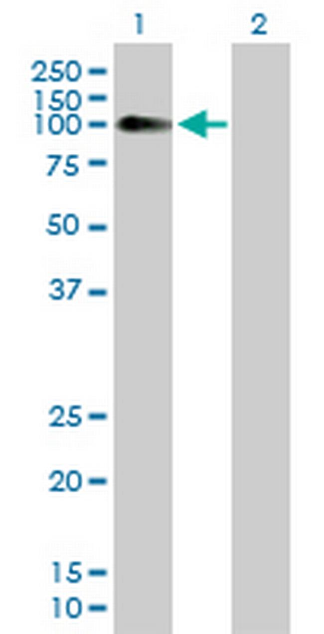 NLGN4X Antibody in Western Blot (WB)