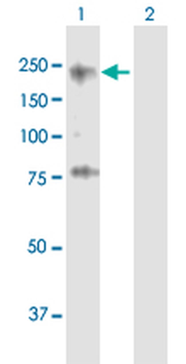 ZNF608 Antibody in Western Blot (WB)