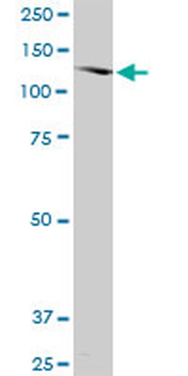 SORCS2 Antibody in Western Blot (WB)