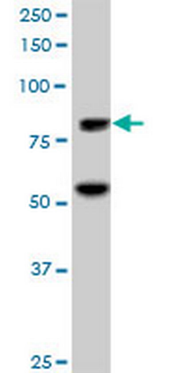 ZNF624 Antibody in Western Blot (WB)
