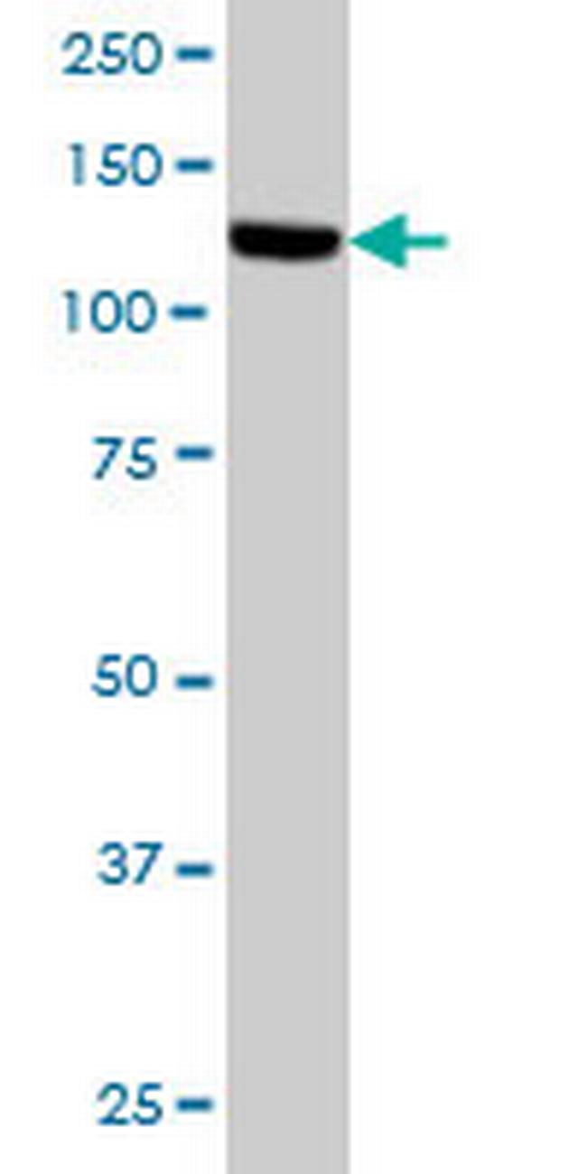 TAOK1 Antibody in Western Blot (WB)