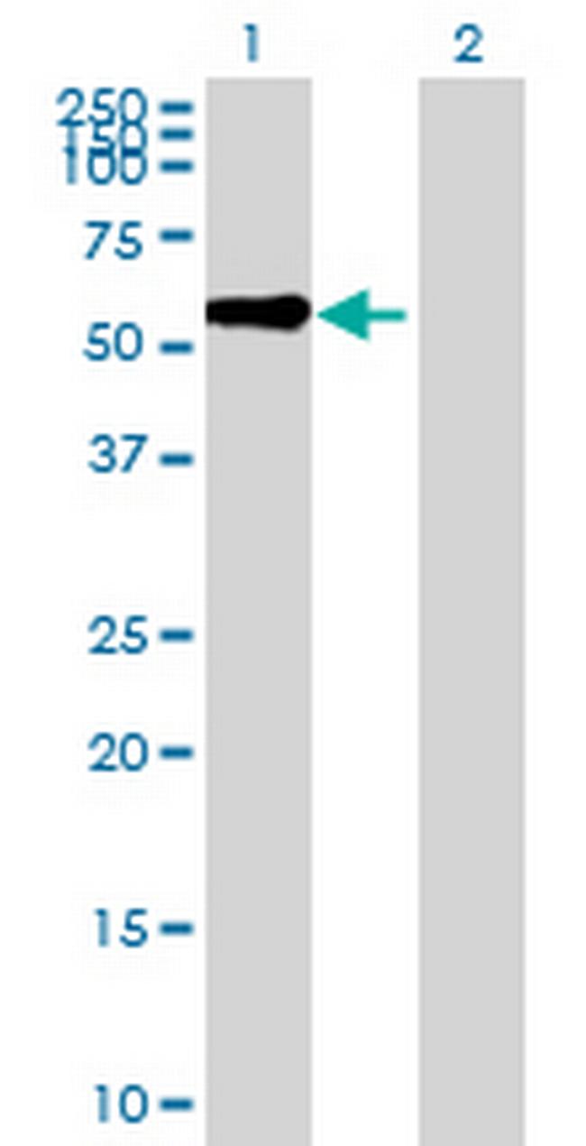KLHL8 Antibody in Western Blot (WB)