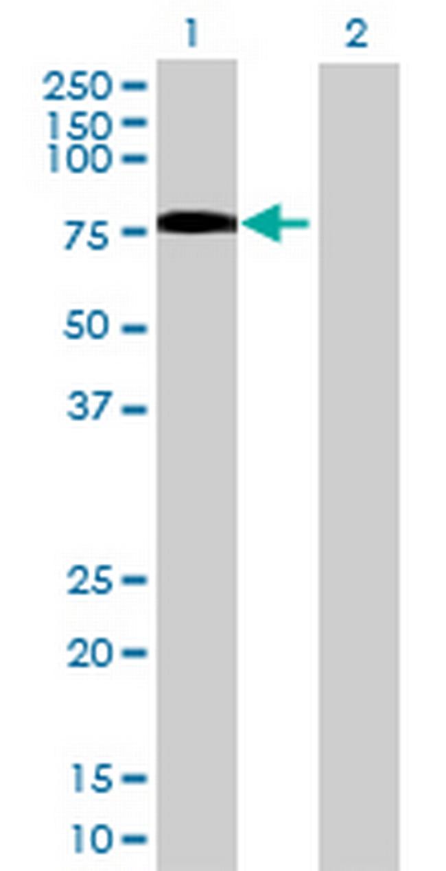 SIPA1L2 Antibody in Western Blot (WB)