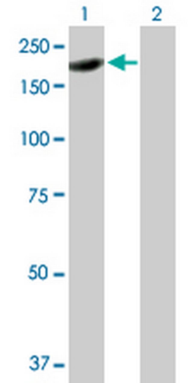 ARHGAP20 Antibody in Western Blot (WB)