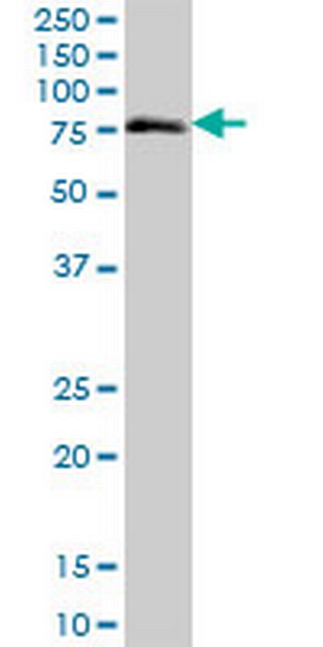 ZNF471 Antibody in Western Blot (WB)