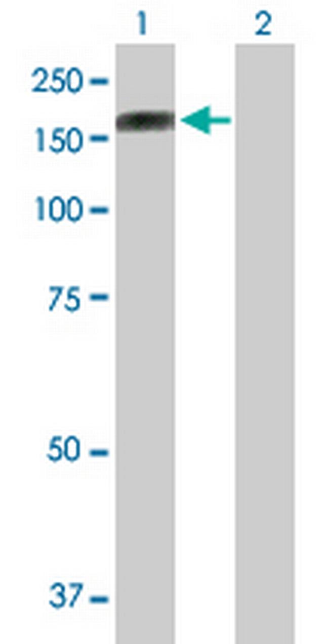 PCDH10 Antibody in Western Blot (WB)