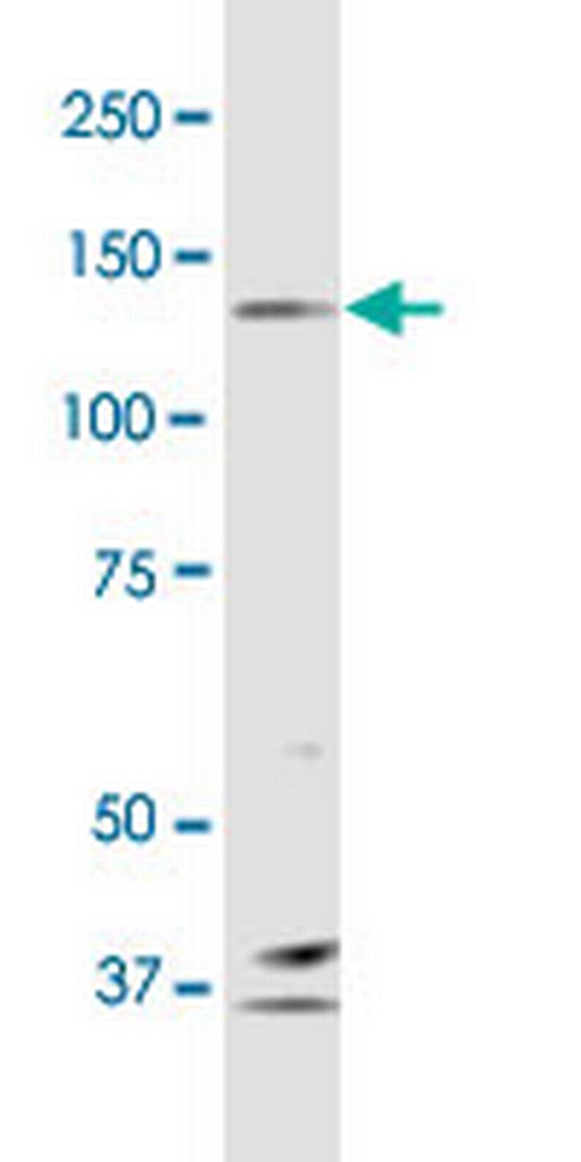 PCDH10 Antibody in Western Blot (WB)