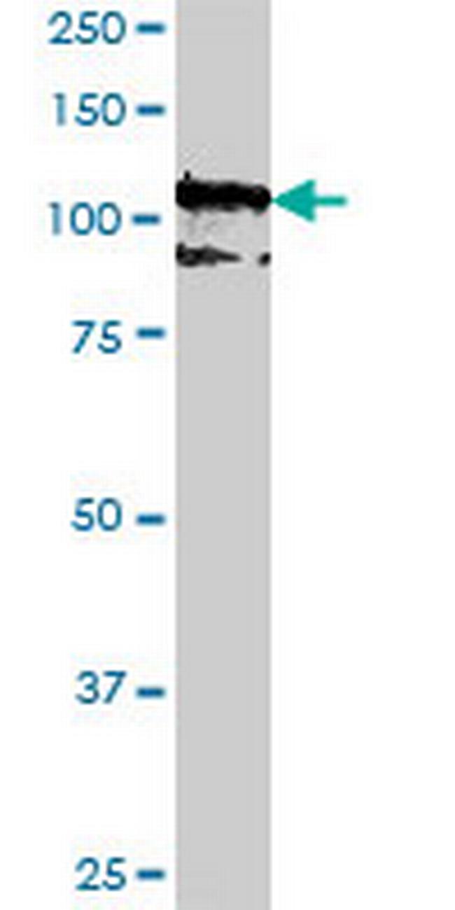 PCDH10 Antibody in Western Blot (WB)