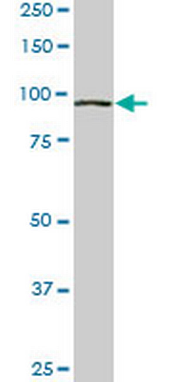 VPS18 Antibody in Western Blot (WB)