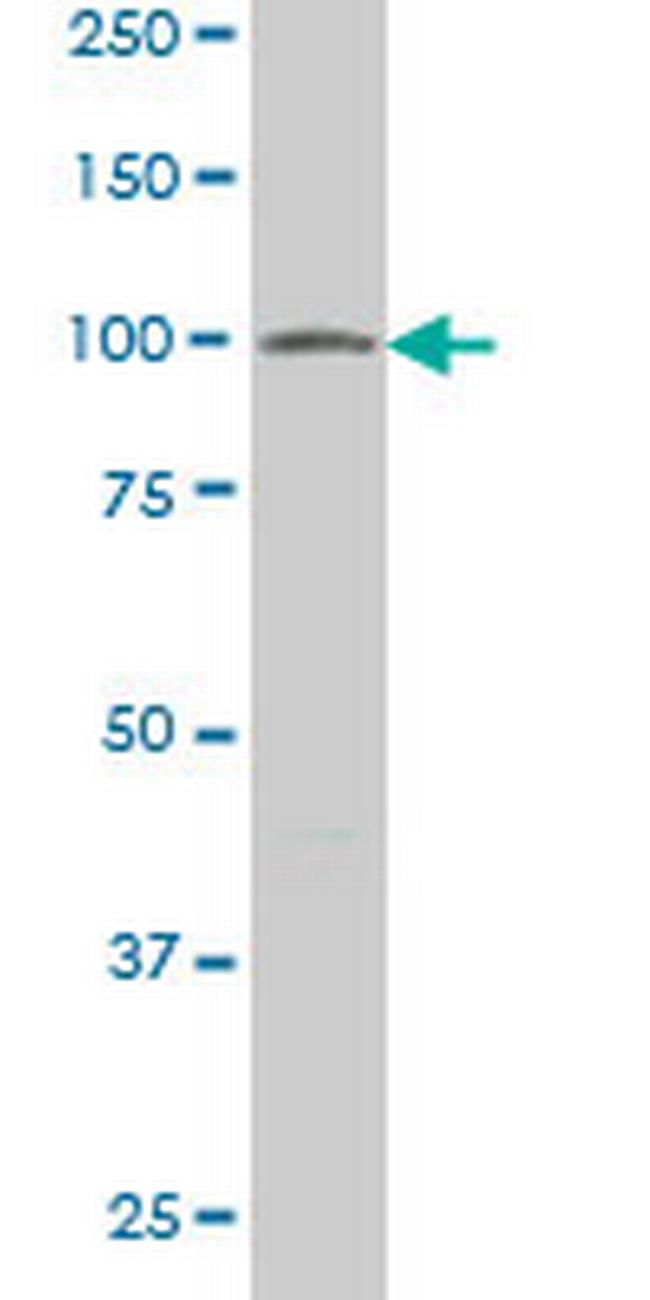 VPS18 Antibody in Western Blot (WB)