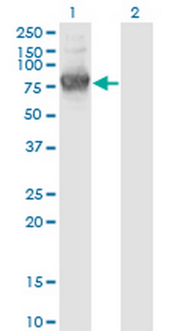 KLHL1 Antibody in Western Blot (WB)