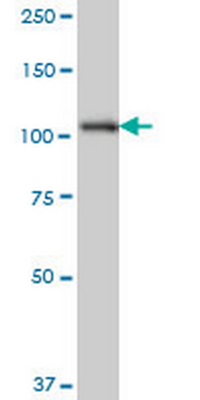 SH3MD2 Antibody in Western Blot (WB)