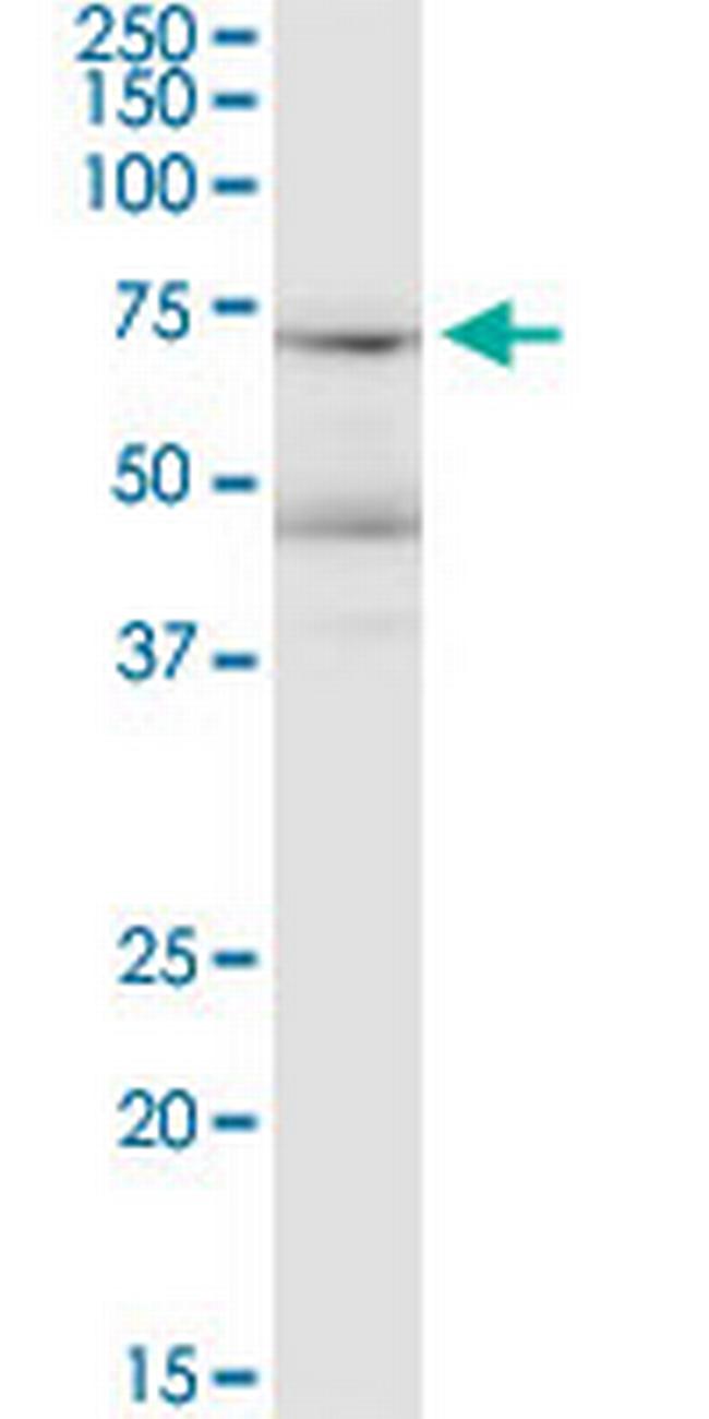 LRRN1 Antibody in Western Blot (WB)