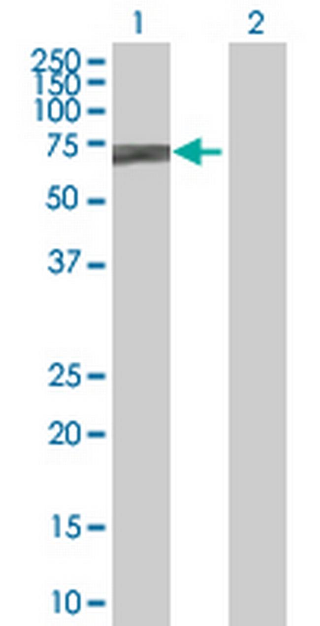 POGK Antibody in Western Blot (WB)