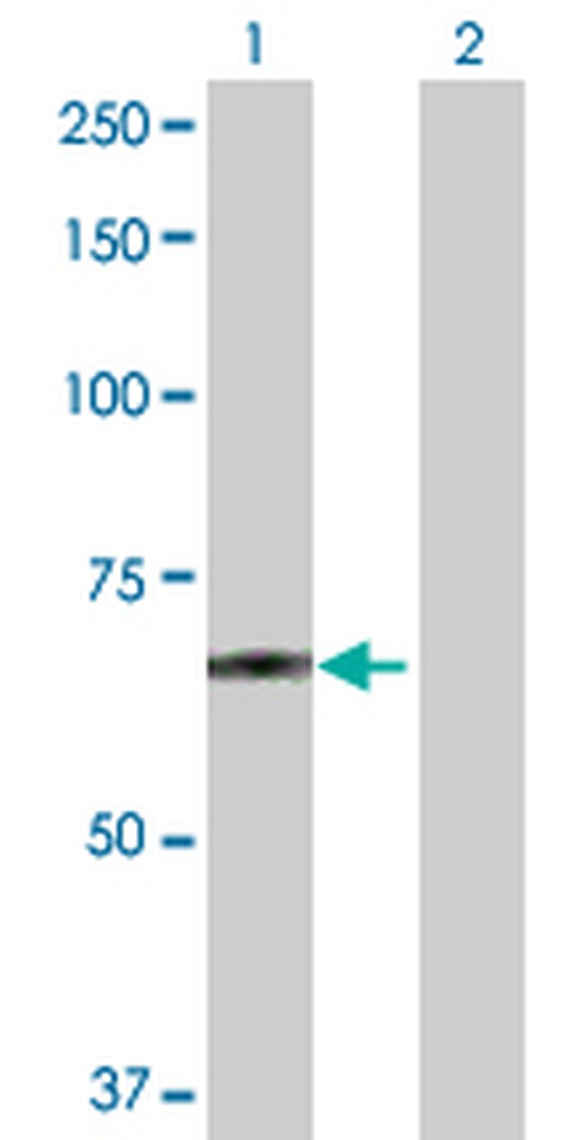 POGK Antibody in Western Blot (WB)