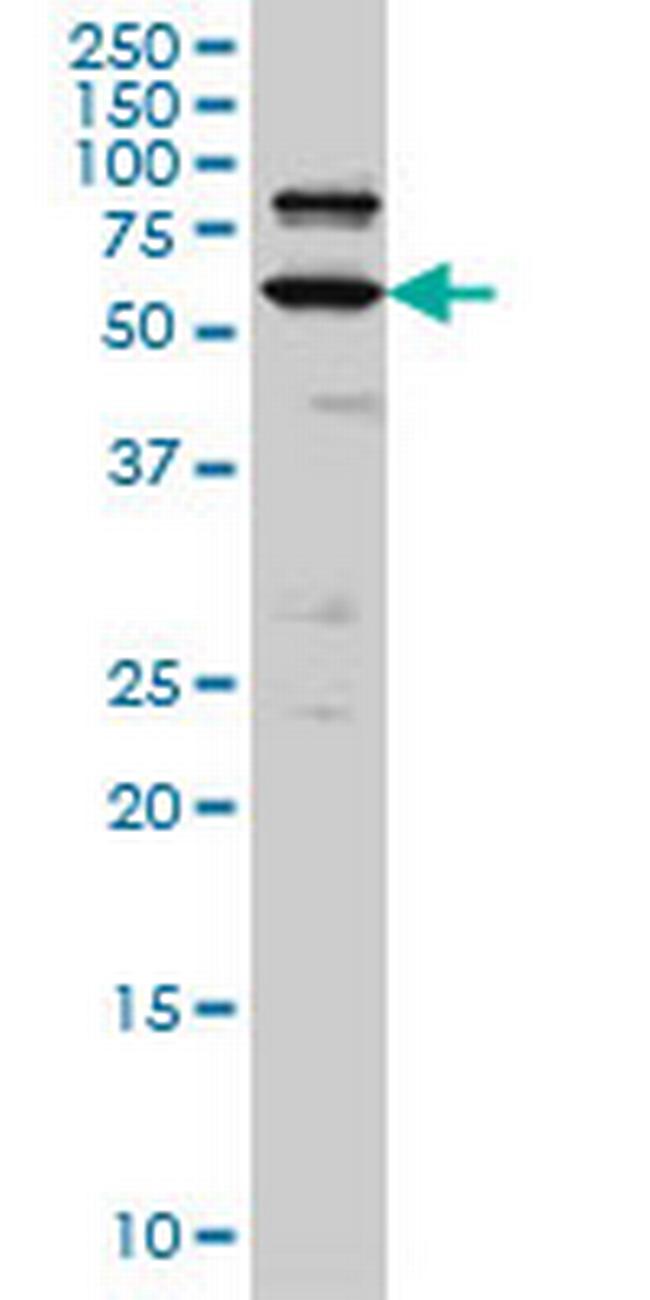 POGK Antibody in Western Blot (WB)