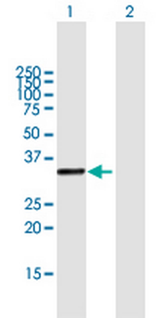 KIAA1530 Antibody in Western Blot (WB)