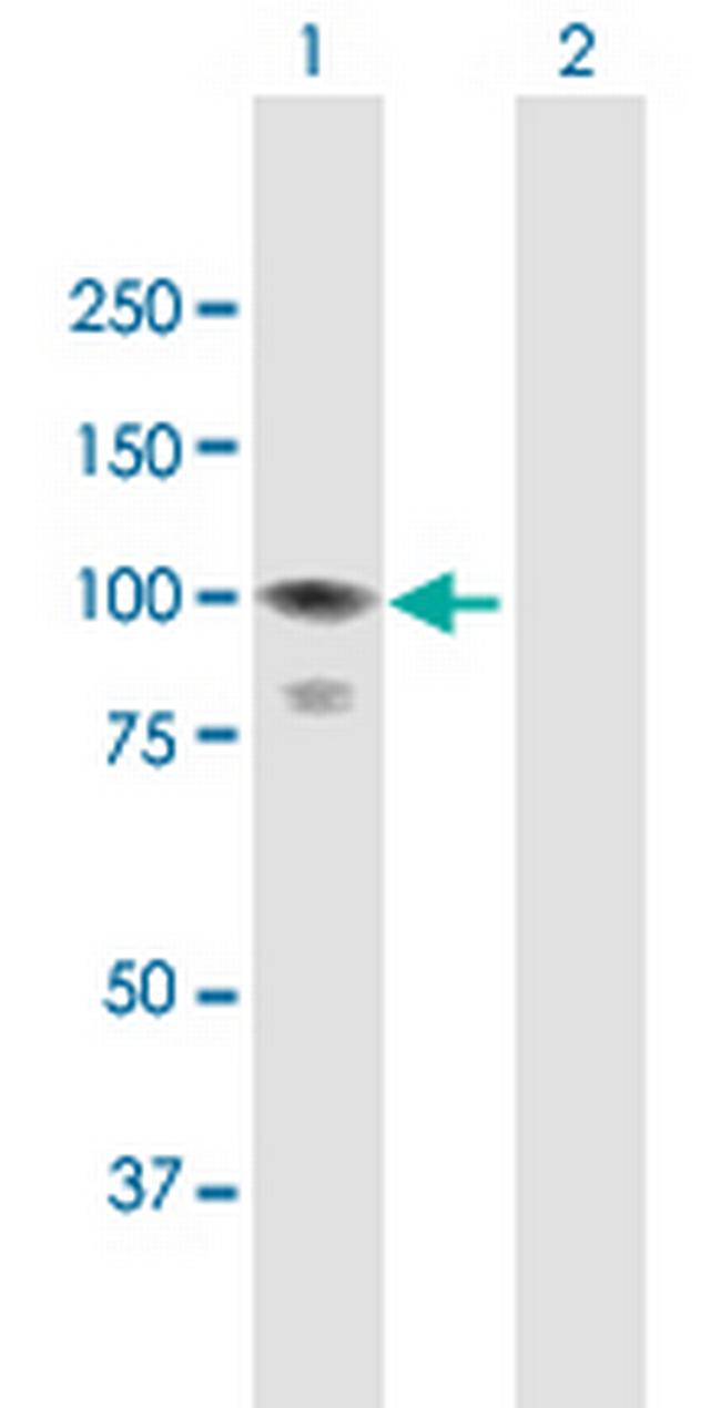CALCOCO1 Antibody in Western Blot (WB)