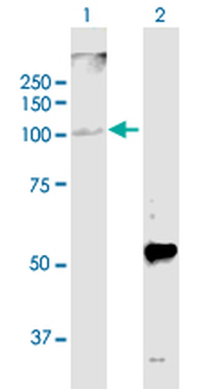 GPAM Antibody in Western Blot (WB)