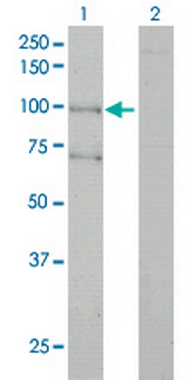 ALS2 Antibody in Western Blot (WB)