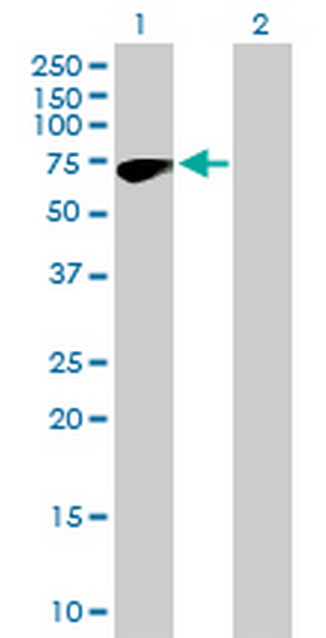 ZNF317 Antibody in Western Blot (WB)
