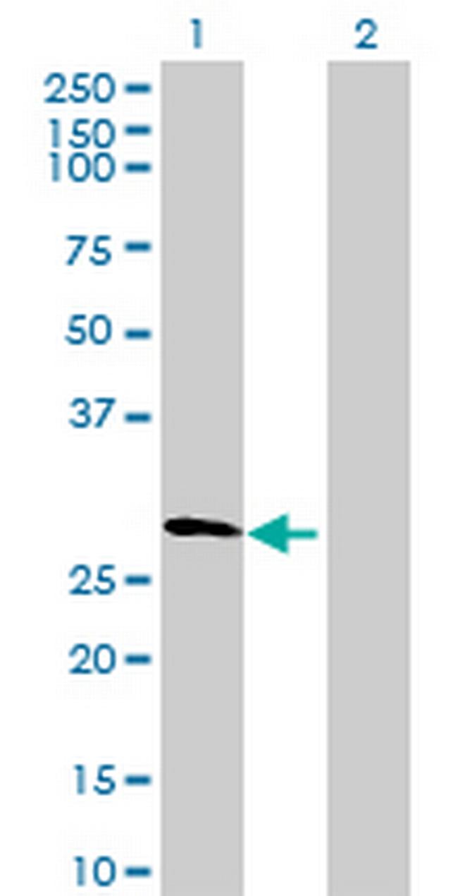 DDX55 Antibody in Western Blot (WB)