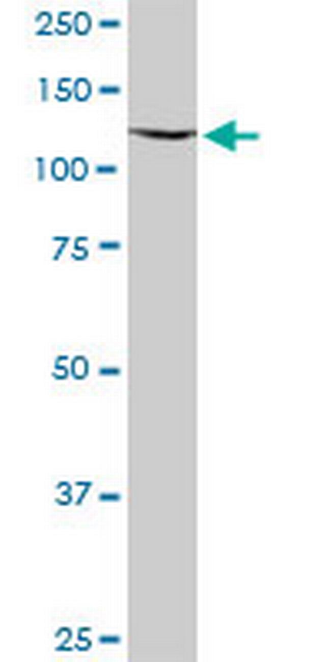 KIAA1604 Antibody in Western Blot (WB)