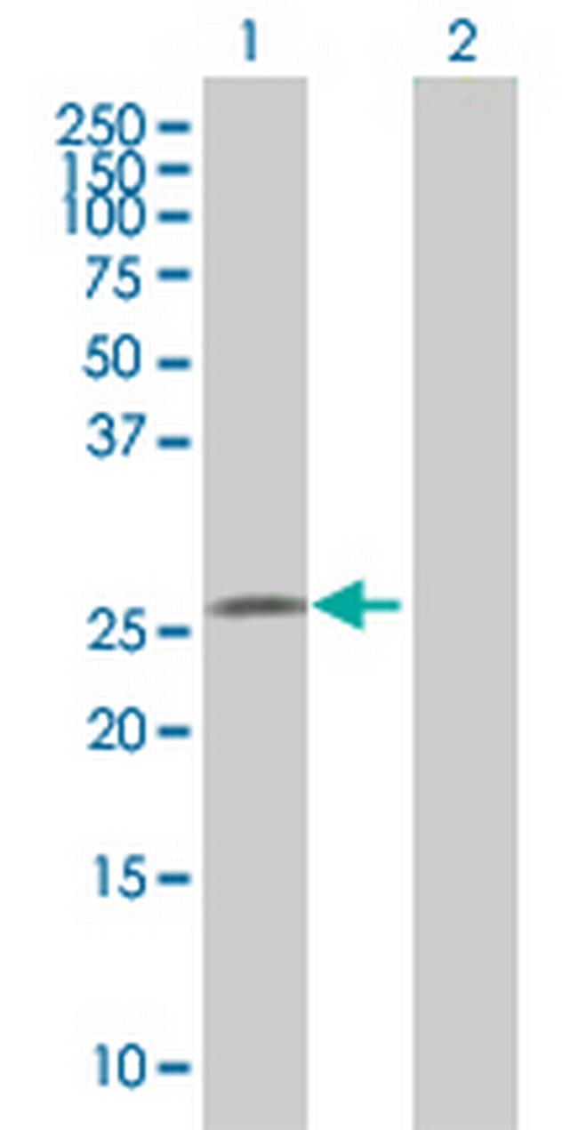 MIER1 Antibody in Western Blot (WB)
