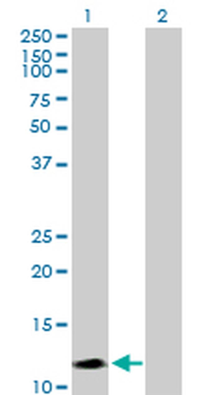 SEMA4G Antibody in Western Blot (WB)