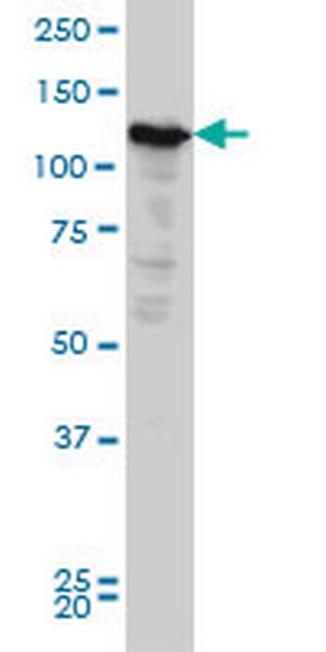 NOPE Antibody in Western Blot (WB)