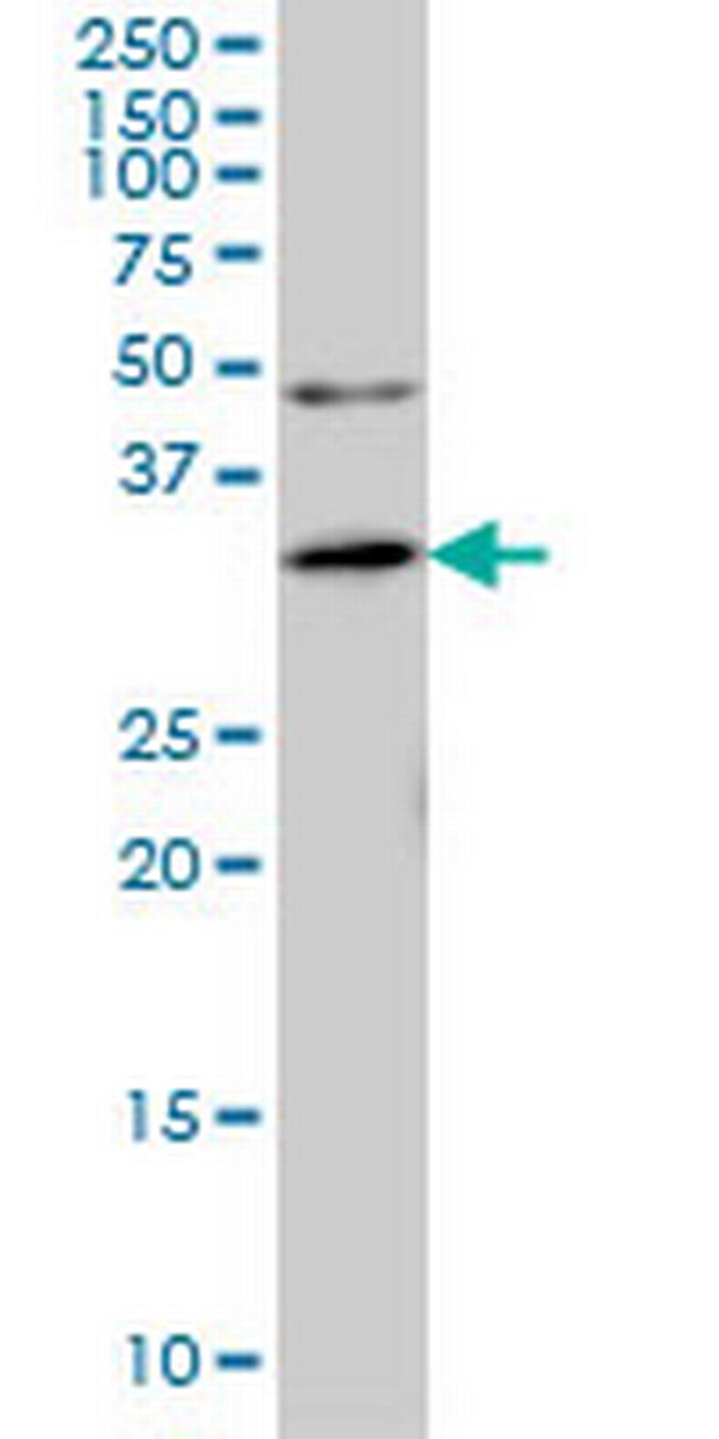 ANKRA2 Antibody in Western Blot (WB)