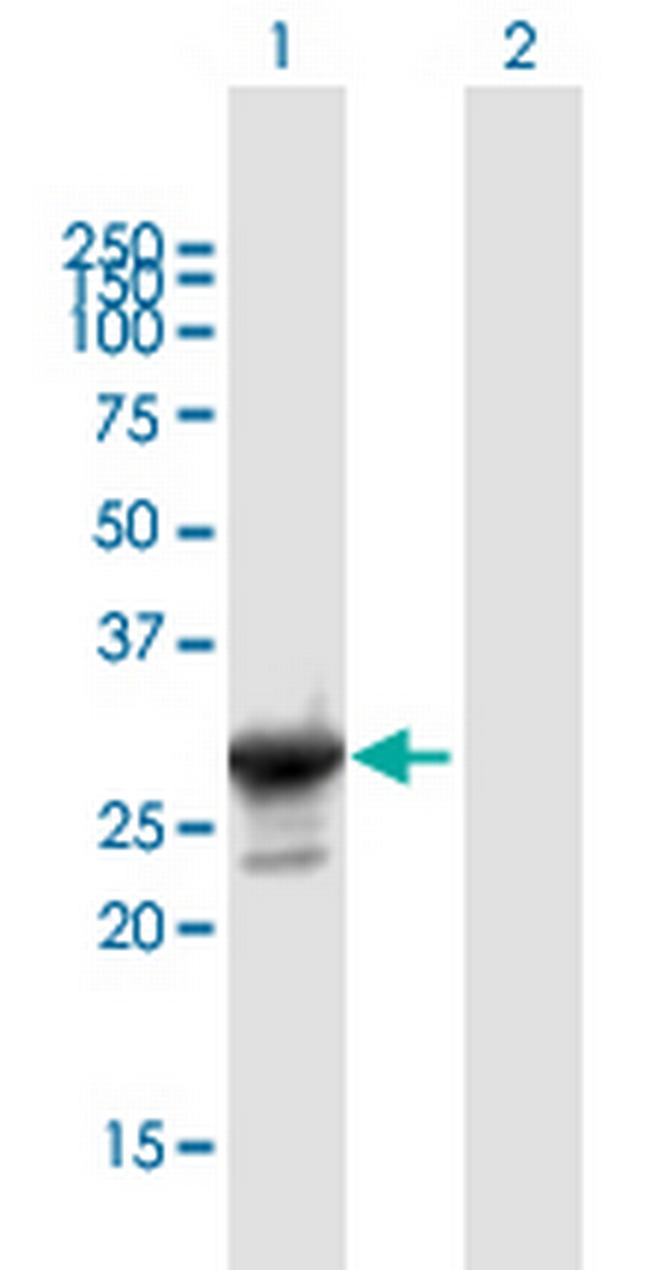GATAD1 Antibody in Western Blot (WB)