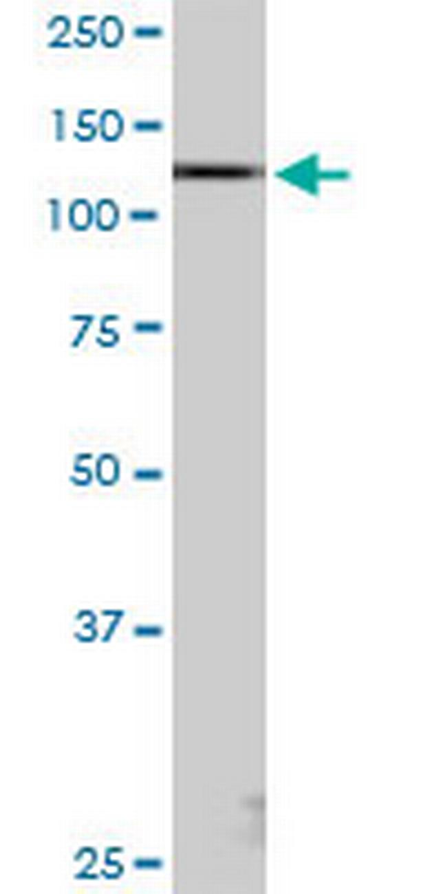 KIAA1967 Antibody in Western Blot (WB)