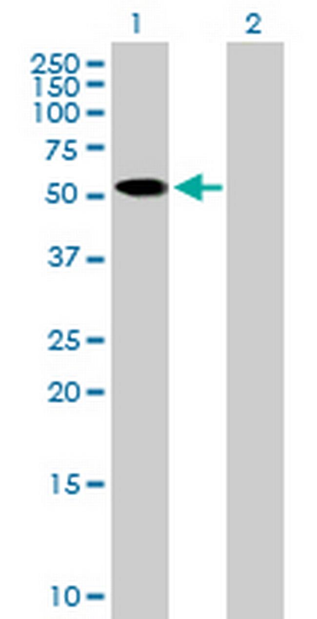 ZNF410 Antibody in Western Blot (WB)