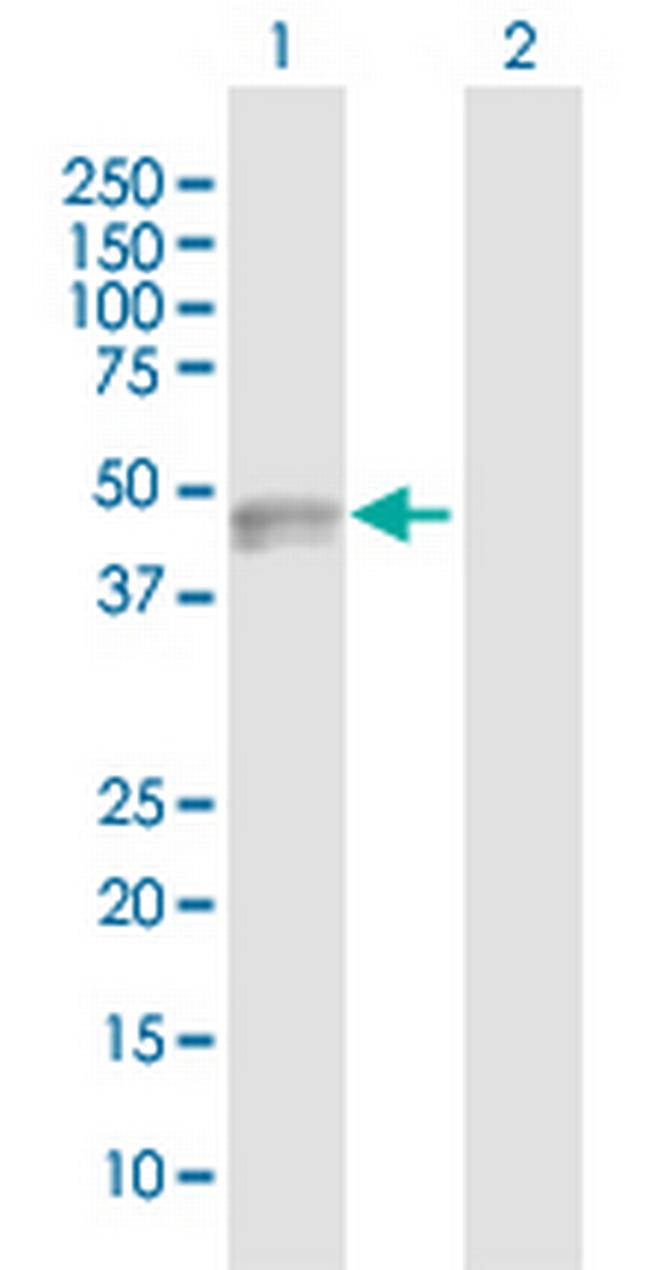 CADM3 Antibody in Western Blot (WB)