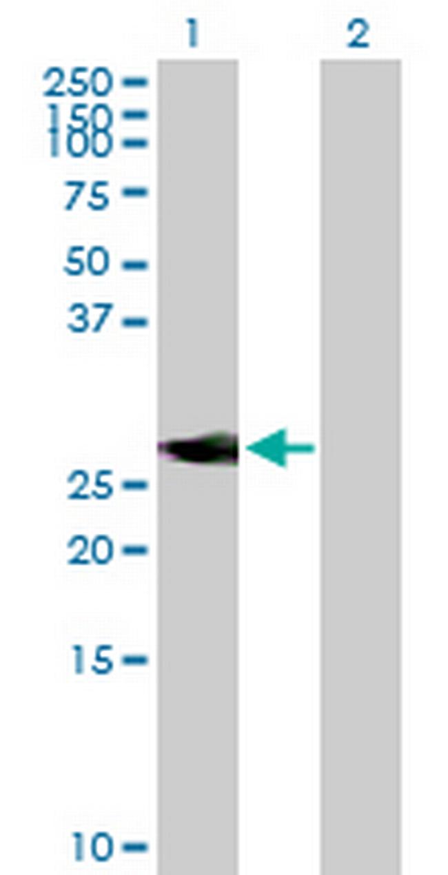 NEUROD4 Antibody in Western Blot (WB)