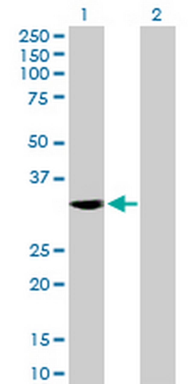 NEUROD4 Antibody in Western Blot (WB)
