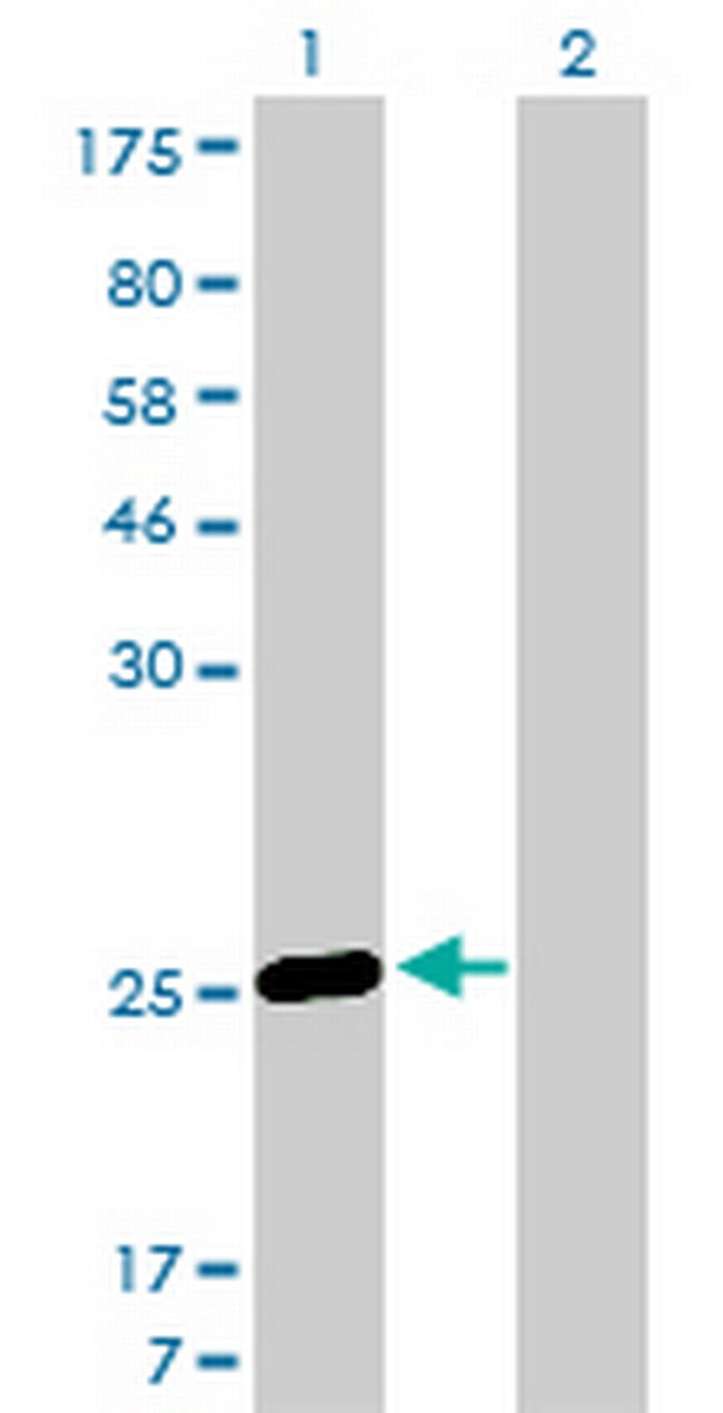MS4A7 Antibody in Western Blot (WB)