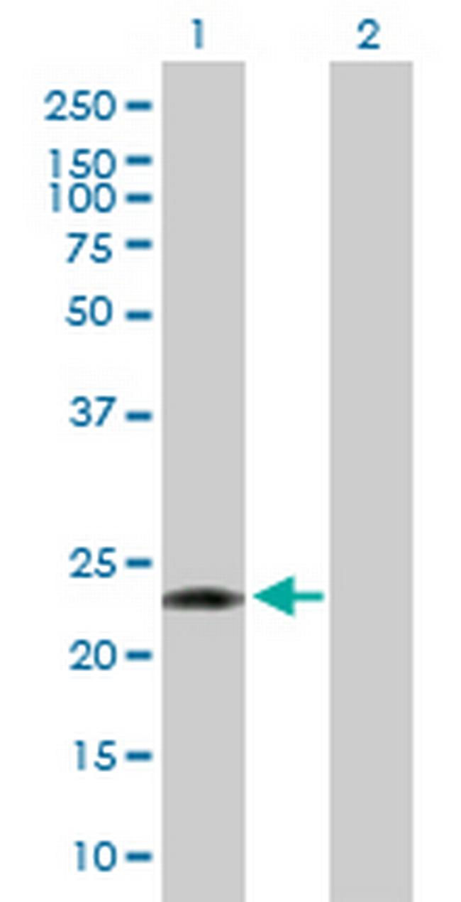 PCTP Antibody in Western Blot (WB)