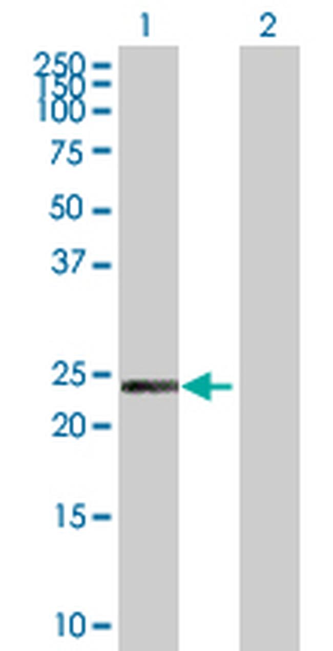 PCTP Antibody in Western Blot (WB)
