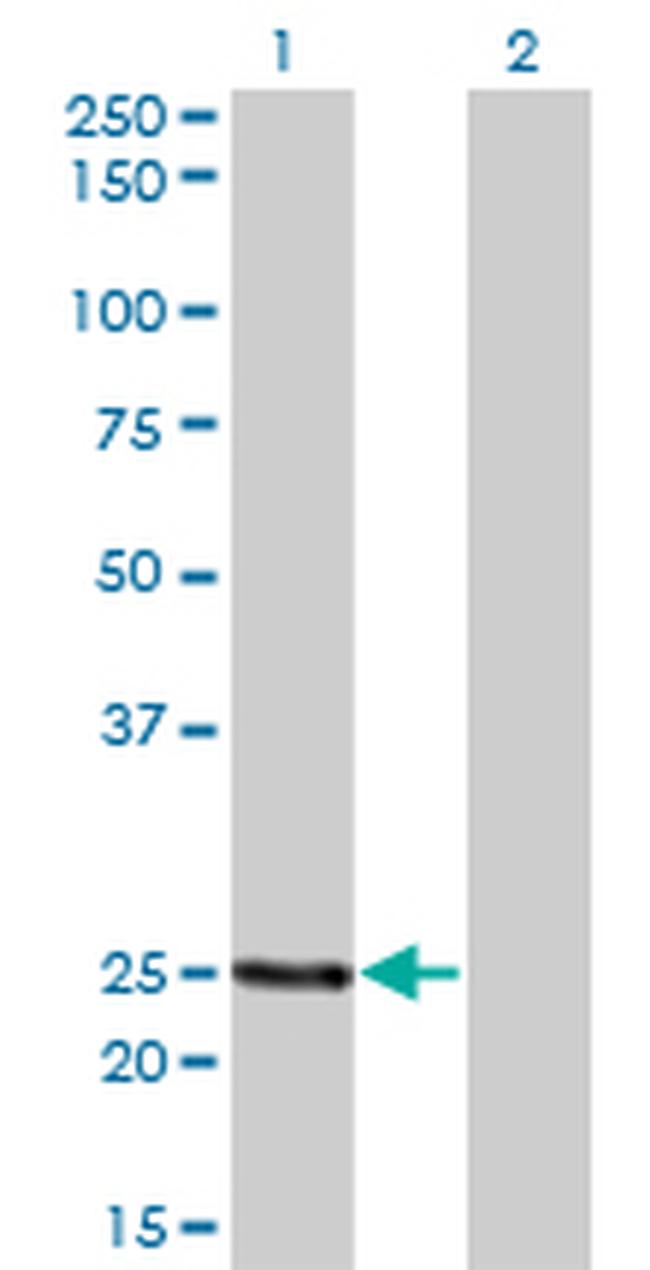 PCTP Antibody in Western Blot (WB)