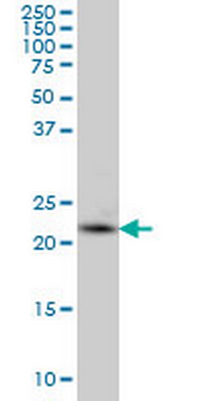 PCTP Antibody in Western Blot (WB)