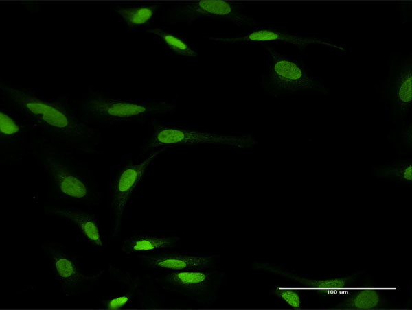 ZNF71 Antibody in Immunocytochemistry (ICC/IF)