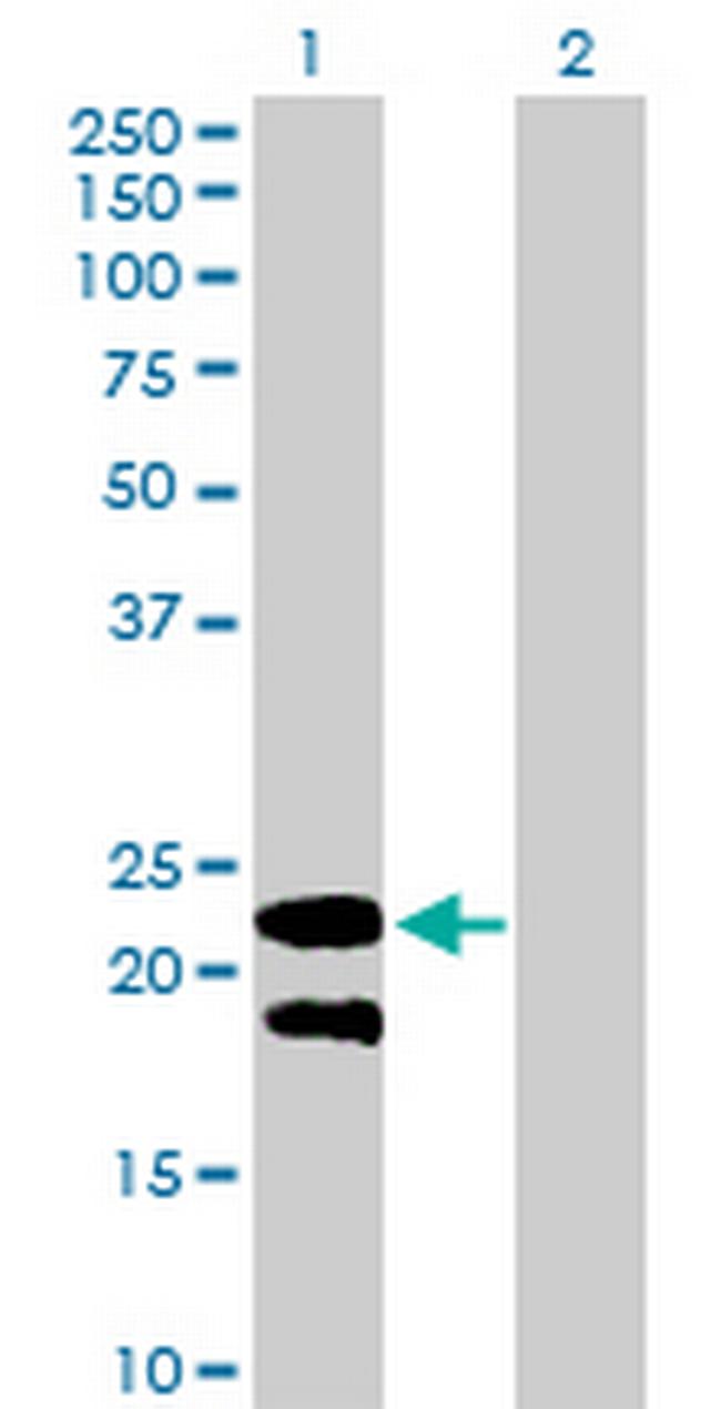 LY6G5B Antibody in Western Blot (WB)