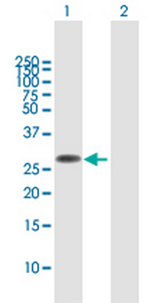 FAM60A Antibody in Western Blot (WB)