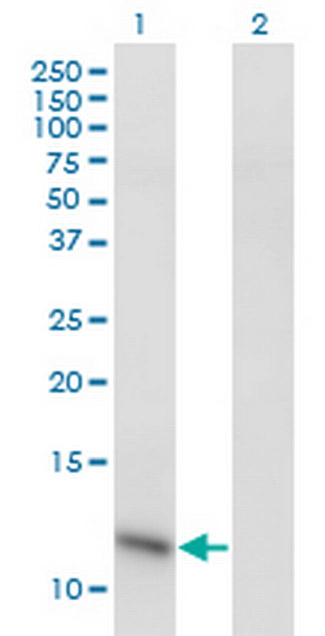 C6orf115 Antibody in Western Blot (WB)