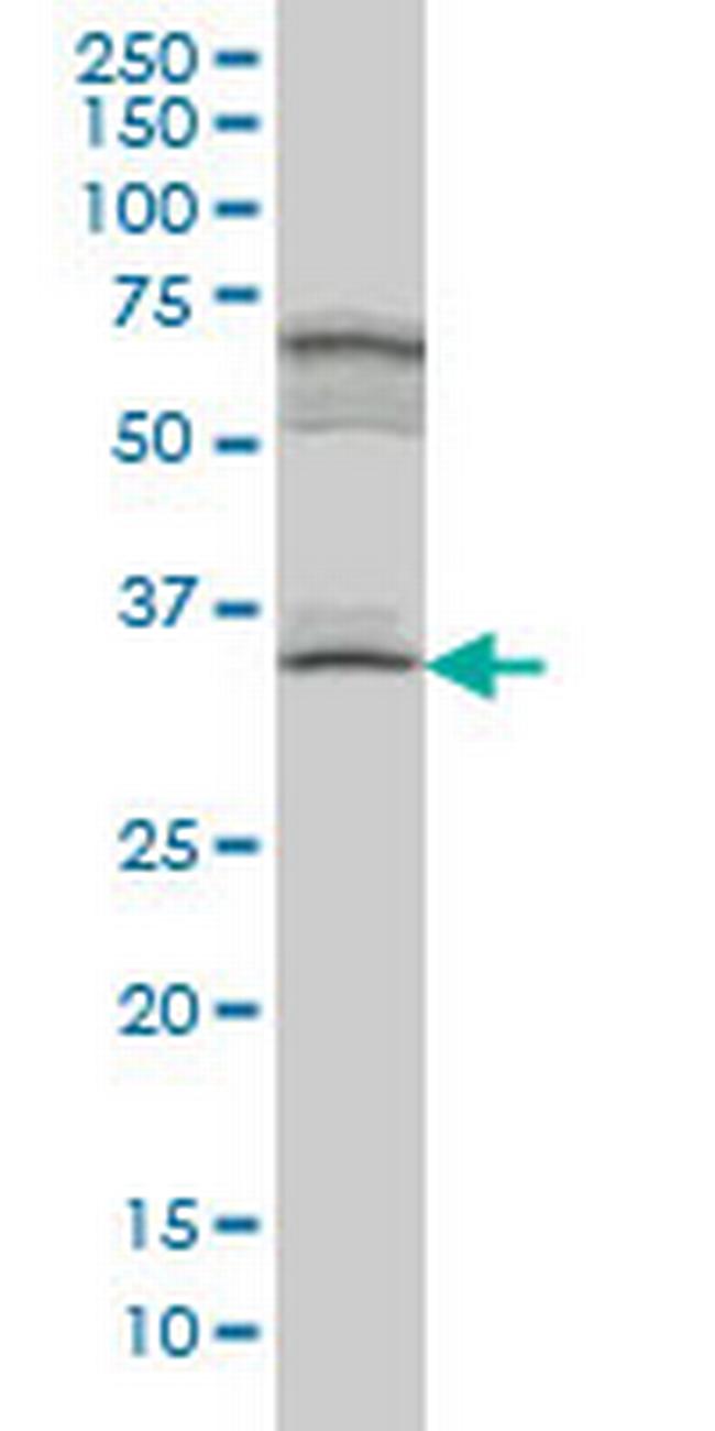 MYOZ1 Antibody in Western Blot (WB)