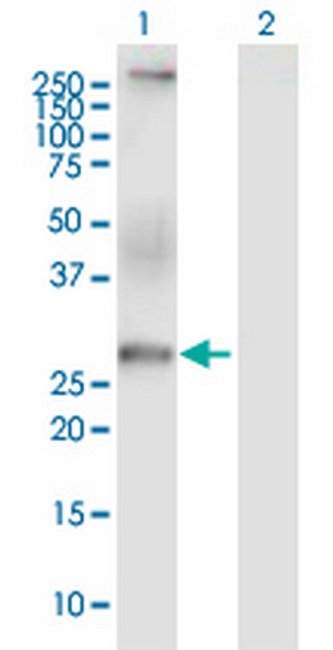 CACNG6 Antibody in Western Blot (WB)