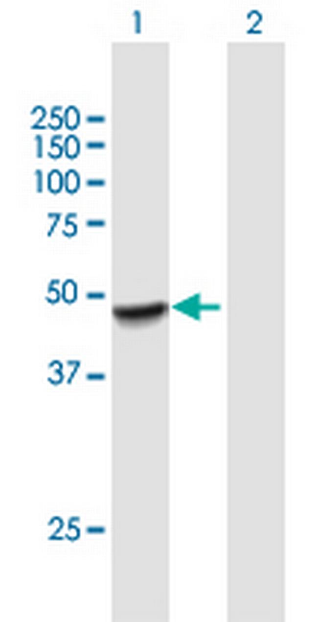 PLEKHA1 Antibody in Western Blot (WB)